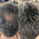 Prime Hair – Camuflagem Capilar Profissional