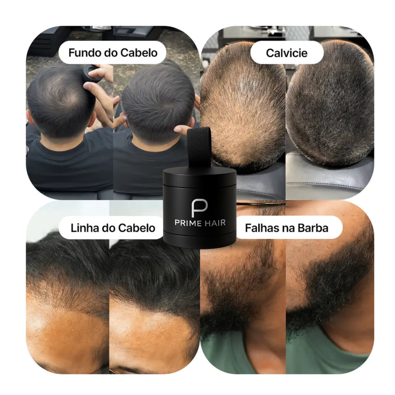 Prime Hair – Camuflagem Capilar Profissional