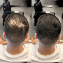 Prime Hair – Camuflagem Capilar Profissional