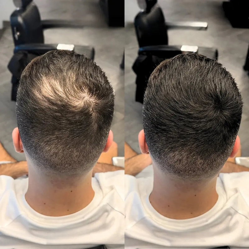 Prime Hair – Camuflagem Capilar Profissional