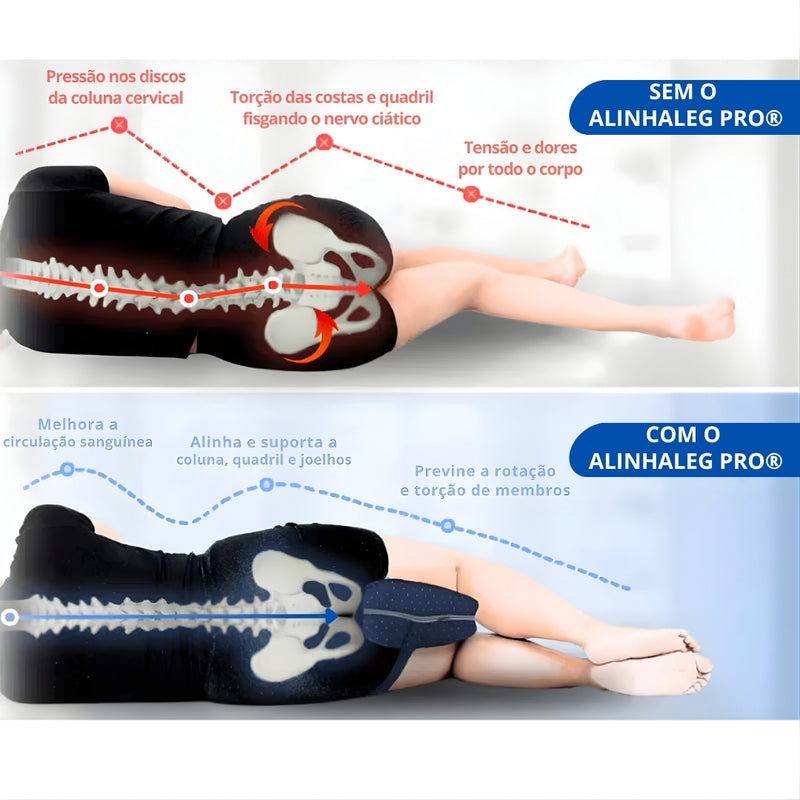 Travesseiro de Alinhamento - AlinhaLeg Pro®